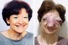 Жизнь француженки, мечтавшей об эвтаназии, была похожа на ад