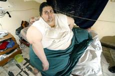 Самый толстый человек в мире похудел в два раза