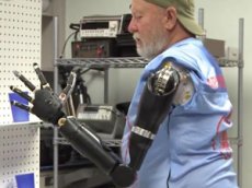 Мужчина получил две роборуки вместо ампутированных 40 лет назад