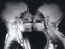 Ученые показали на видео, как выглядит секс в аппарате МРТ