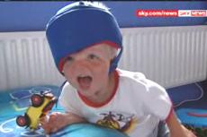 В Великобритании живет мальчик, у которого отсутствует половина черепа