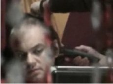 Киркоров стал лысым