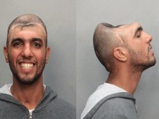 Человек без мозга