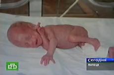 Липецкие врачи спасли 450-граммового новорожденного