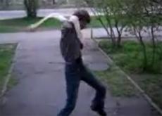 Британский школьник мечтает использовать в будущем свои уникальные руки