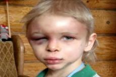 Приемная мать до полусмерти избила 4-летнего сына