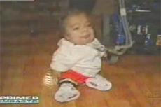 В Колумбии живет юноша с телом младенца