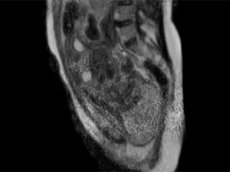 Учёные засняли роды с помощью томографа