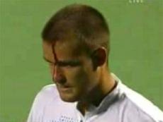 Ролик, где Михаил Южный избивает сам себя ракеткой, стал хитом YouTube