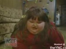 Самый жирный ребенок в мире похудел на 140 кг