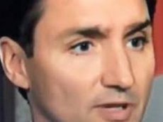 В Сети обсуждают «отваливающуюся» бровь премьер-министра Канады
