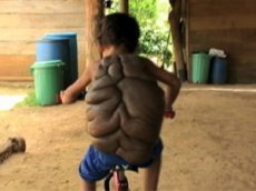 Мальчик — черепаха