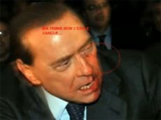 Берлускони мог подстроить нападение на самого себя