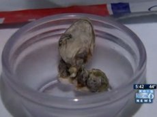 Женщина нашла в упаковке с фасолью голову змеи