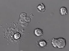 Ученые впервые сняли на видео смерть лейкоцита