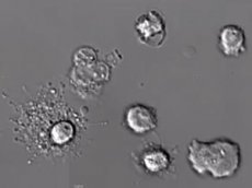 Ученые впервые сняли на видео смерть лейкоцита