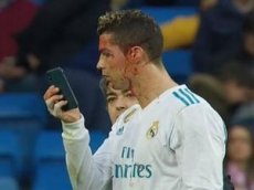 РОНАЛДУ РАССТРОИЛ ВИД ЕГО ЛИЦА ПОСЛЕ НЕПРИЯТНОГО ИНЦИДЕНТА