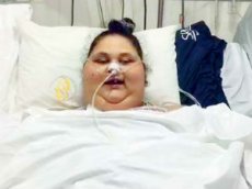 Самая толстая женщина в мире станцевала после операции