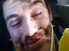 Самая спокойная жертва ДТП