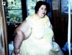 Во Флориде умерла самая толстая женщина в мире