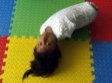 В Перу родилась девочка без конечностей