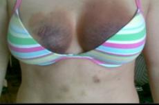 Чемпионку мира по дзюдо избил любовник