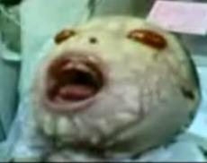 В Саудовской Аравии родился ребенок-мутант