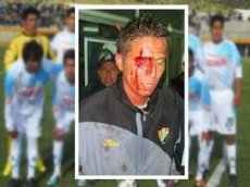 В Перу кдва не линчевали игрока, не забившего пенальти