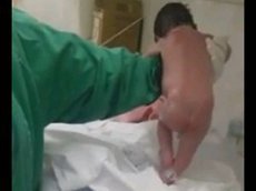 Малыш совершил первые шаги сразу после появления на свет
