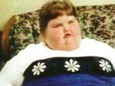 Самый жирный ребенок в мире