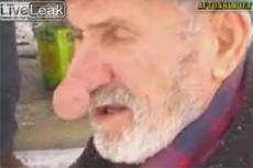 Человек с самым длинным носом живет в Турции