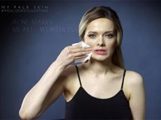 Ролик в поддержку страдающих от прыщей посмотрели 8 миллионов раз за неделю