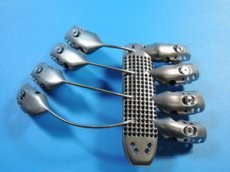 Человеку вживили титановую грудную клетку, напечатанную на 3D-принтере