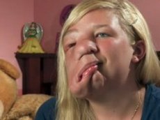 Канадская школьница с опухолью на лице стала звездой интернета