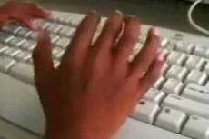 В Индии живет шестипалый мальчик