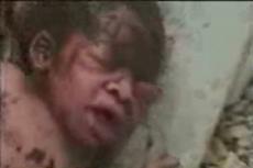 Ребенок, найденный в экскрементах, будет жить