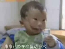 В Китае родился двуликий малыш