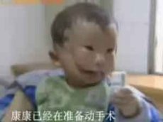 В Китае родился двуликий малыш