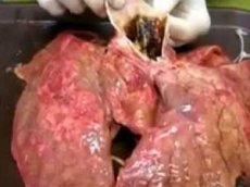 Как выглядят легкие после 60 сигарет. Видеофакт