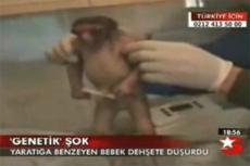 В Индии женщина родила "обезьянку"