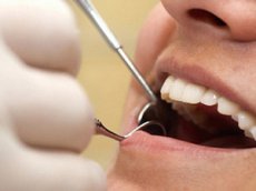 Стоматолог снял на видео удаление собственного зуба (Внимание, ролик не для слабонервных!)