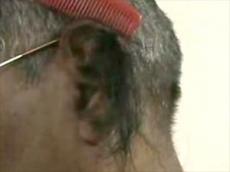 Индиец вырастил самые длинные в мире волосы в ушах