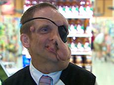 Покупатели решили помочь изуродованному опухолью продавцу