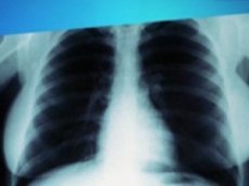 В Лас-Вегасе на аукцион выставят рентгеновские снимки Мэрилин Монро