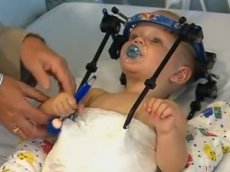 Врачи пришили младенцу почти оторванную голову