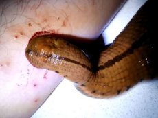 Пиявка размером с полруки заменила мужчине кота