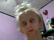 Новая звезда интернета — TsimFuckis — рэпер с синдромом преждевременного старения