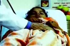 Пагубная привычка есть свои  волосы едва не привела к смерти индийскую девочку