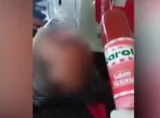 В Румынии фельдшер избил пациента колбасой