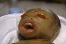 В Малайзии родился ребенок-инопланетянин